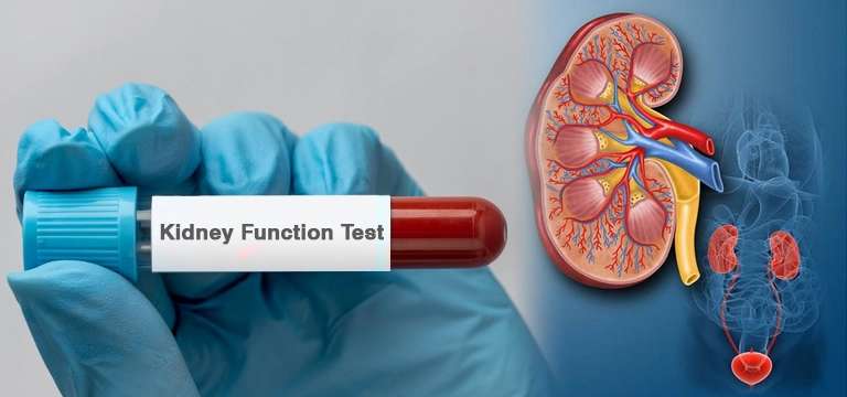 Kidney function test at pathology lab - kidney health markers in Agra